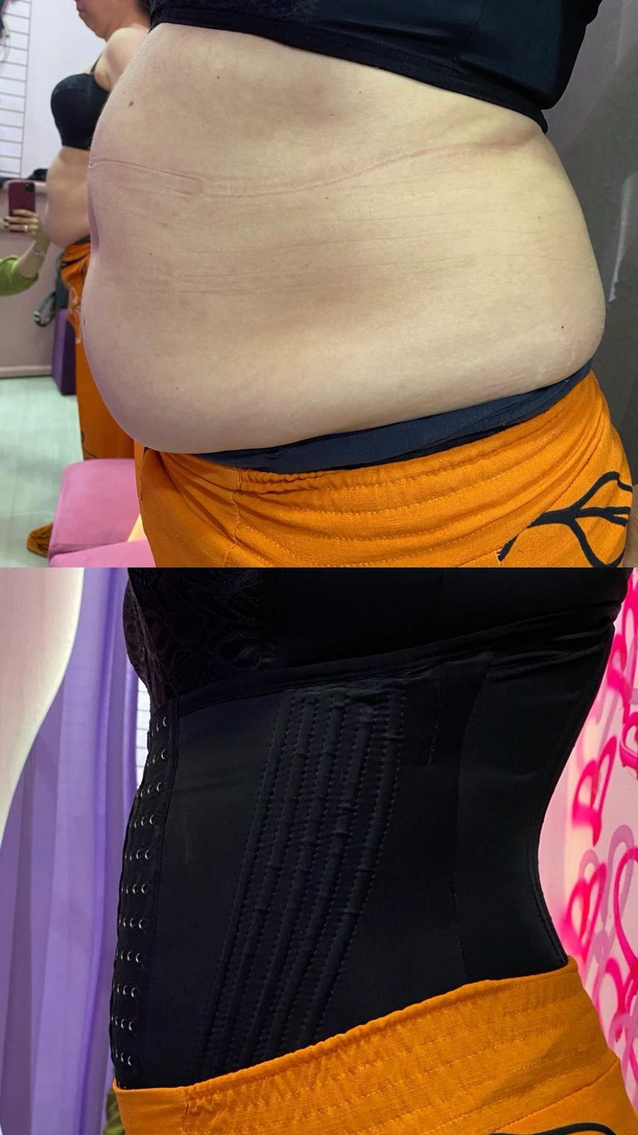 Abdômen de lado antes e depois de fechar a cinta preta